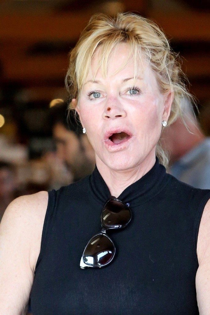 West Hollywood, CA  - *EXCLUSIVE* Melanie Griffith gets camera shy as she steps out for groceries at Bristol Farms with messy hair and no make up revealing a scab on her nose. Pictured: Melanie Griffith BACKGRID USA 8 SEPTEMBER 2017, Image: 348809930, License: Rights-managed, Restrictions: , Model Release: no, Credit line: Profimedia, AKM-GSI